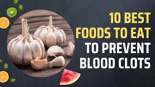 10 Best Foods To Eat To Prevent Blood Clots