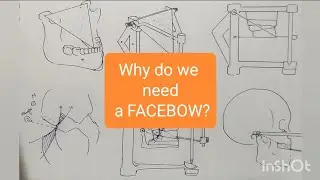DENTAL FACEBOW | Indications and Concepts