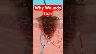 Why Wounds Itch:  Science Explained 🩹 #medical #medicalstudent #science #sciencefacts #woundcare