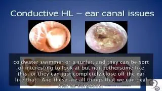 Hearing Restoration Summit: Sujana Chandrasekhar, MD discusses degrees of hearing loss
