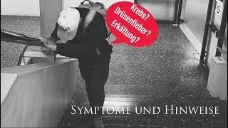 Ist es Krebs? Symptome und Hinweise