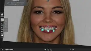 Digital Smile Designing at Top Class Dental