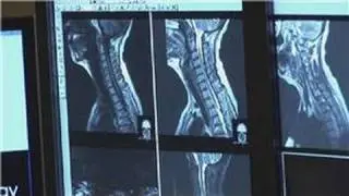 X-Rays : What Are the Risks of X-Rays?