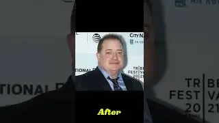 Brendan Fraser Before And After. #BrendanFraser#BeforeAndAfter#Transformation#Glow#HollywoodComeback