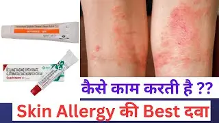 The Shocking Truth About Nuforce GM Cream Uses and Warnings You Need to Know
