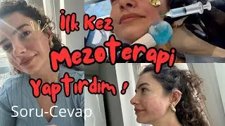 İLK KEZ MEZOTERAPİ ve DERMAPEN YAPTIRDIM ❗️Acıdı Mı ? Ne İşe Yarıyor ? Kimlere Yapılmaz ? SORU-CEVAP