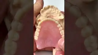 Transformation from short teeth!