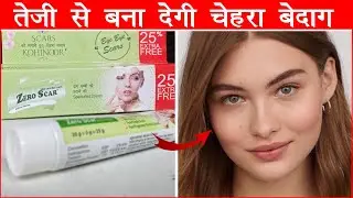 Zero scar cream | Pimple, Acne, Strech Marks, सब ख़त्म करदे | Hindi