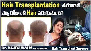 How Much Time it Takes to Grow Hair After Hair Transplant || Hair Transplant Journey Day by Day