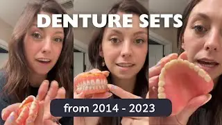 My Dentures through the years 2014-now
