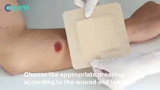 ConkoXtra(Super Absorbent Dressing with Silicone Border)- How to Use
