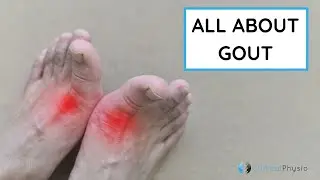What is Gout? All you need to know!