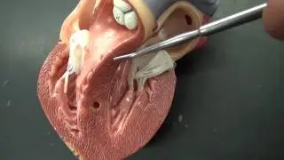 HEART ANATOMY QUIZ: INTERVENTRICULAR SEPTUM.MTS