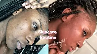 Plus  d'HYPERPIGMENTATION,  de TEXTURE et PEAU TERNE| Routine soin de visage jour et nuit PEAU NOIRE