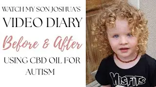 CBD OIL FOR AUTISM..WATCH JOSHUAS AMAZING TRANSFORMATION