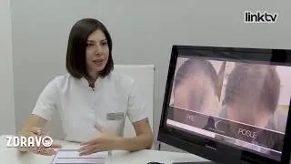 Kako pobediti ćelavost ? - Dr Elena Arsova, Zdravo sa Dunjom