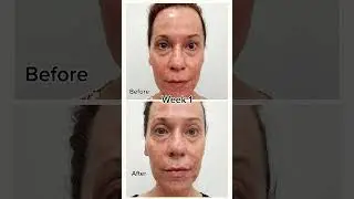 My 4-Week Results Using Retinal