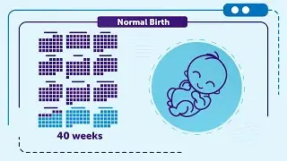 RECAP Preterm - Improving the quality of life of children and adults born very preterm