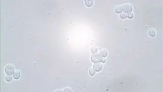 Budding and Shmooing - Yeast Reproduction