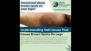 5 Vein Conditions That Cause Brown Spots On Legs