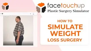 How to use FaceTouchUp Plastic Surgery Simulator to simulate Bariatric or weight loss surgery