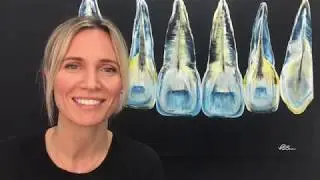 Myth: Spacing between baby teeth is not normal
