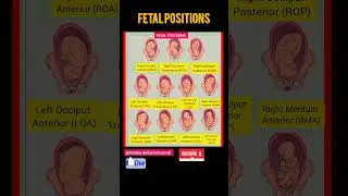 Fetal positions🚼#positions#fetus#medical #nursing#shorts