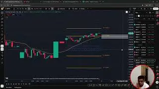 121 for Nifty expiry trade explained with 10 lakh margin
