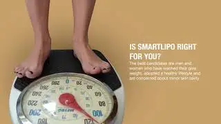 What to Expect before, during & after Smartlipo