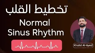 تخطيط القلب: Normal Sinus Rhythm :: خالد العايد