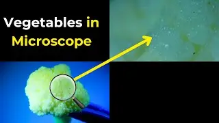 Vegetable in microscope