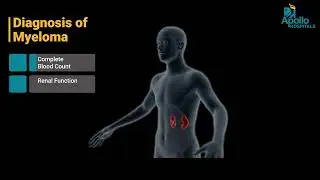 Dr. Vishwanath S | فهم المايلوما المتعددة | Apollo Hospitals