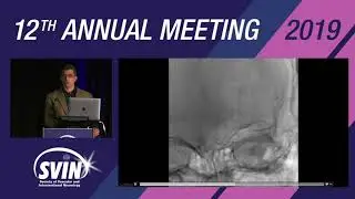 SVIN 2019: Complex Carotid Stenting/Tandem Occlusion