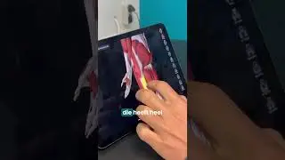 Pijn aan de zijkant van je knie?