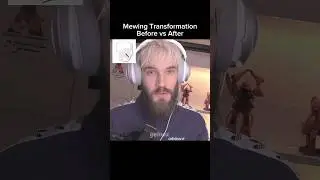 Mewing Transformation