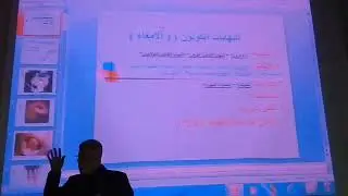 باطنة هضمية | تتمة أورام الأمعاء + التهابات الأمعاء د.مازن زادة
