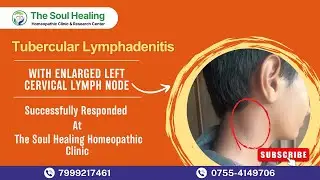 Tubercular Lymphadenitis Treated Naturally Without Surgery|The SoulHealing Homeopathic Clinic|Bhopal