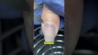 Cuticle Removal Mistake 😱💅 (How to Do It Right & Safe)