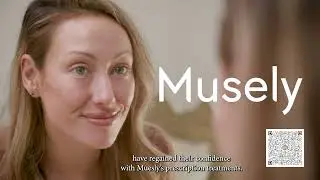 Treat Postpartum Melasma with Musely Prescription Treatments