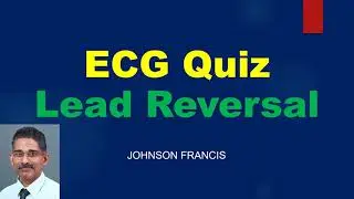 ECG Quiz - Lead Reversal