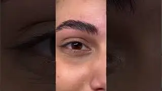 Kaş Vitamini Sonrası İnanılmaz Değişim! Danışanımızın Ger&ccedil;ek Hikayesi