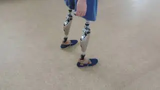 C-Leg 4 от Отто Бокк (Otto Bock). Ходьба на протезах бедра при парной ампутации.