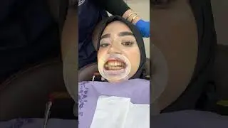 #shortvideo #dentist #salonday #blogger #lovelake #dentalclinic #like #lakelover #dentistry #reels