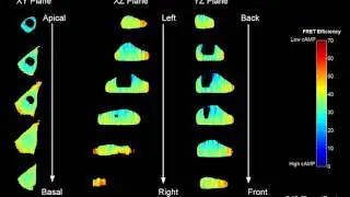 5D Imaging - 3D Spatial + Hyperspectral + Timelapse