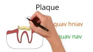 Common Dental Terms in Hmong Part 1  #hmong #medical #terminology