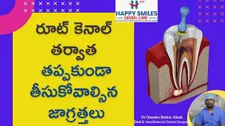 Care After Root Canal | రూట్‌ కెనాల్  తర్వాత ఈ జాగ్రత్తలు తీసుకోవాల్సిందే | Dr.Chandra Shekar Alladi