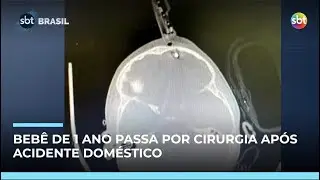 Bebê de 1 ano cai da cama e fica com carregador cravado na testa em MG | #SBTBrasil