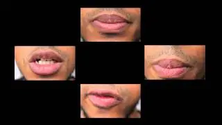 Pasteur H-Capella