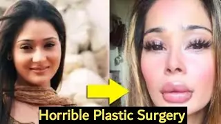 TV Actress Who Looks Horrible After Plastic Surgery||Actresses Surgery Went Wrong||MK Bollywood