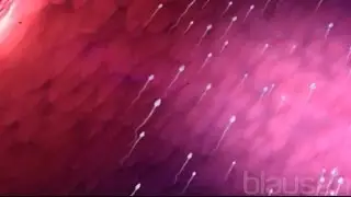 HIV Animation